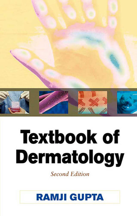 Textbook Of Dermatology
